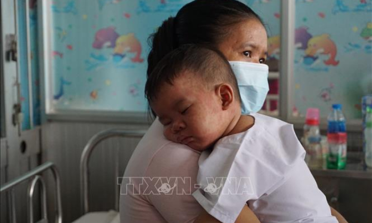 Khu vực phía Nam: Sốt xuất huyết chưa hạ nhiệt, bệnh sởi gia tăng