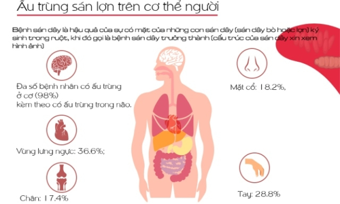 Nhận diện về bệnh sán dây, ấu trùng sán lợn