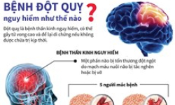 Bệnh đột quỵ nguy hiểm như thế nào?