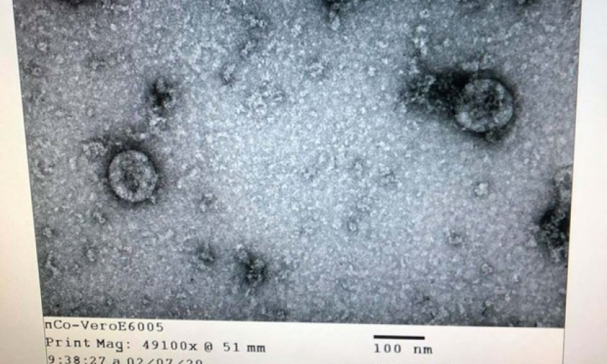 Việt Nam nuôi cấy và phân lập thành công virus corona mới