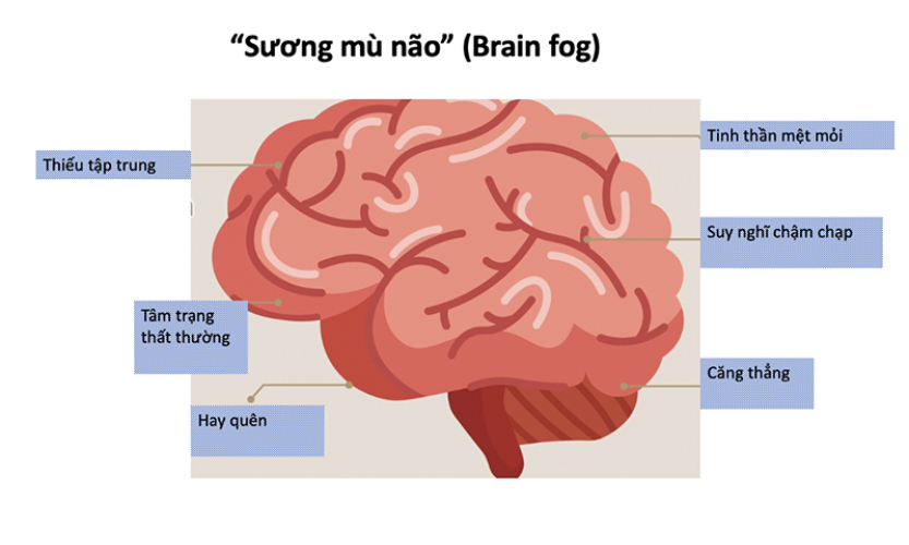 Học kém tập trung, hay quên… có thể mắc sương mù não hậu Covid-19