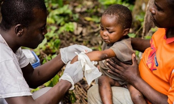 WHO: Chưa cần tiêm đại trà vaccine ngừa bệnh đậu mùa khỉ