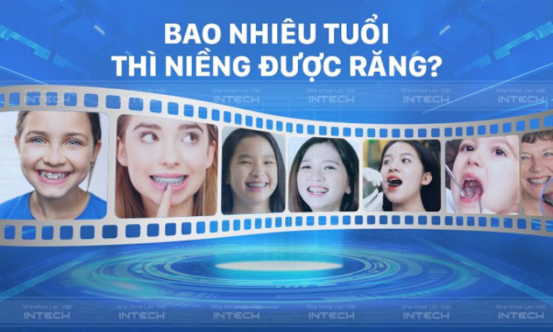 Bao nhiêu tuổi thì niềng răng được? Địa chỉ niềng răng uy tín tại Hà Nội