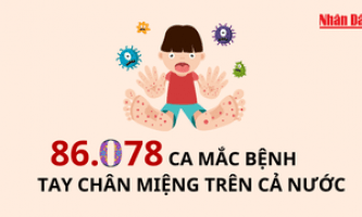 86.078 ca mắc bệnh tay chân miệng trên cả nước