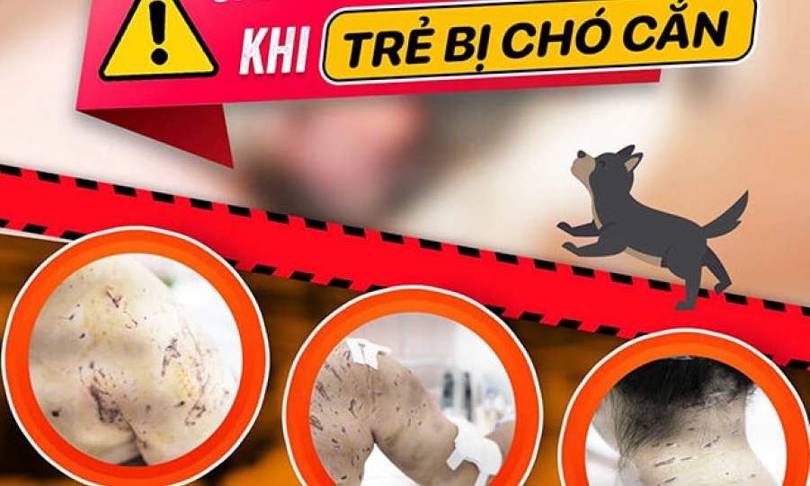 Bé gái bị 4 con chó tấn công với hàng trăm vết thương trên người