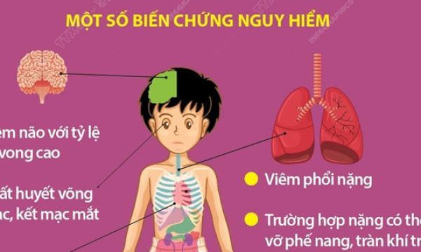 Trẻ mắc ho gà có thể gặp nhiều biến chứng nguy hiểm