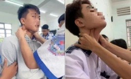 Cảnh báo nguy hiểm chết người từ trào lưu“bắt pen” trên TikTok