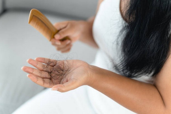 Thiếu protein là một trong những nguyên nhân phổ biến gây rụng tóc. (Ảnh: iStock)