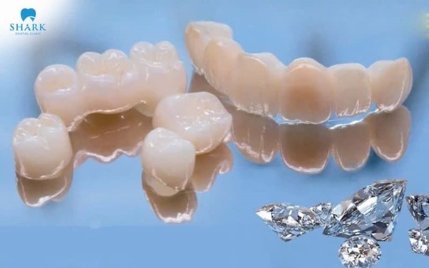 Răng sứ Diamond là răng toàn sứ cao cấp, có màu sắc trắng sáng hoàn hảo