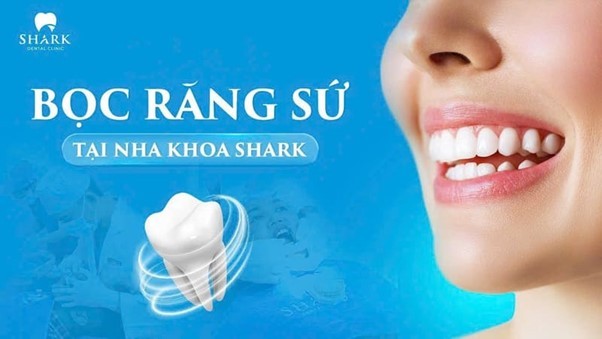 Quy trình bọc răng sứ nhanh chóng được thực hiện bởi bác sĩ có chuyên môn cao tại Nha Khoa Shark