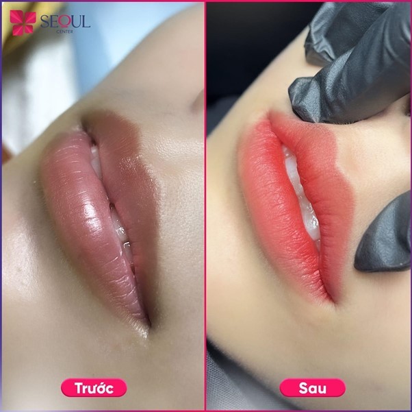 Hình ảnh minh họa trước và sau khi khách hàng phun môi