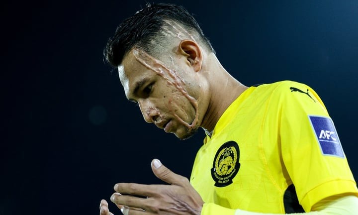 Khuôn mặt biến dạng của Faisal Halim