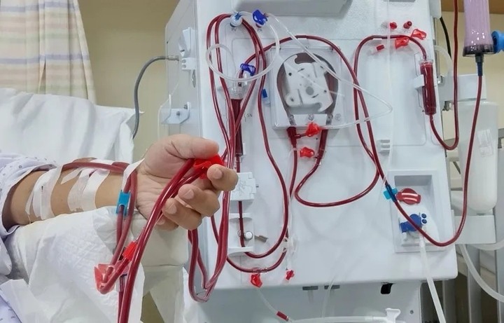 Hệ thống lọc máu được áp dụng cho bệnh nhân chạy thận.