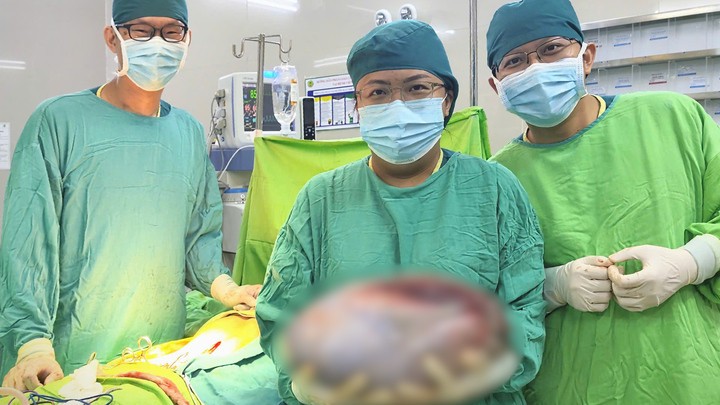 Các bác sĩ tại Bệnh viện Nhi đồng 2, TP.HCM phẫu thuật loại bỏ khối u buồng trứng cho bé gái 13 tuổi. (Ảnh: BVCC)