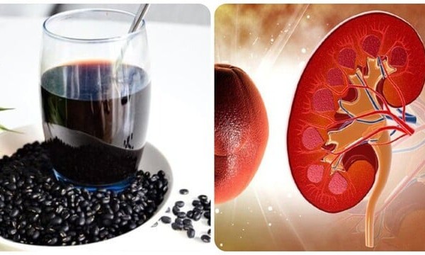 Uống nước đậu đen có tốt cho thận?