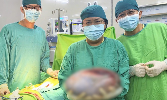 Bé gái 13 tuổi có khối u buồng trứng gần 8 kg